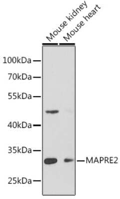 Western Blot: EB2 AntibodyBSA Free [NBP2-92905]